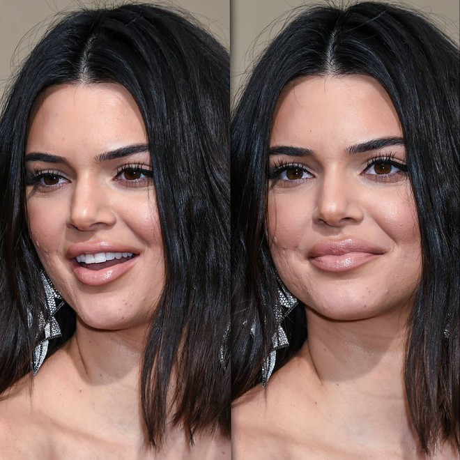 Dù Kendall Jenner lộng lẫy nhất nhì thảm đỏ Quả Cầu Vàng nhưng làn da mụn sần sùi của cô mới là tâm điểm bàn tán - Ảnh 6.