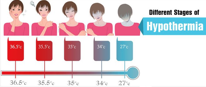 Những bệnh nguy hiểm nhưng rất dễ mắc phải khi trời lạnh - Ảnh 1.