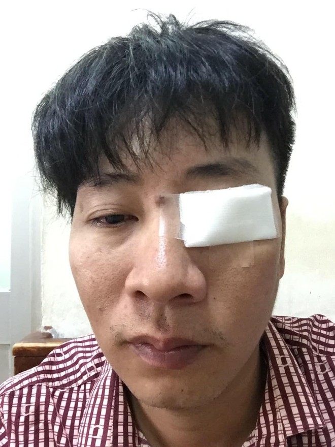 T&agrave;i xế đ&aacute;nh nam thanh ni&ecirc;n xung phong to&eacute;t mắt khi bị nhắc nhở v&igrave; đỗ xe g&acirc;y tắc đường - Ảnh 1.
