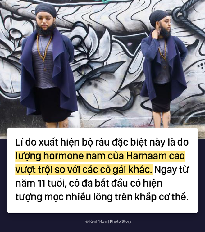 C&acirc;u chuyện về C&ocirc; n&agrave;ng c&oacute; r&acirc;u tự tin tỏa s&aacute;ng trong l&agrave;ng catwalk - Ảnh 3.