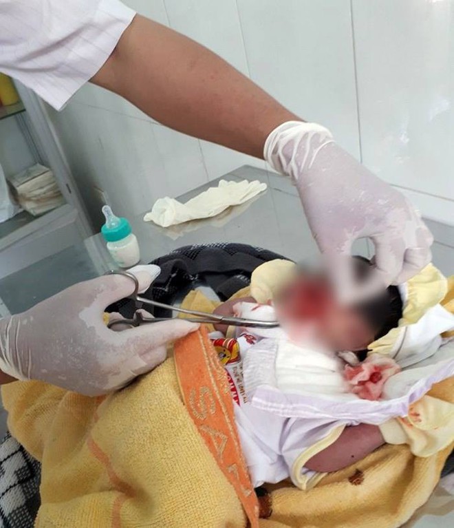 B&igrave;nh Thuận: Hoảng hồn ph&aacute;t hiện một b&eacute; sơ sinh nghi bị ch&ocirc;n sống, c&ograve;n d&acirc;y rốn - Ảnh 1.