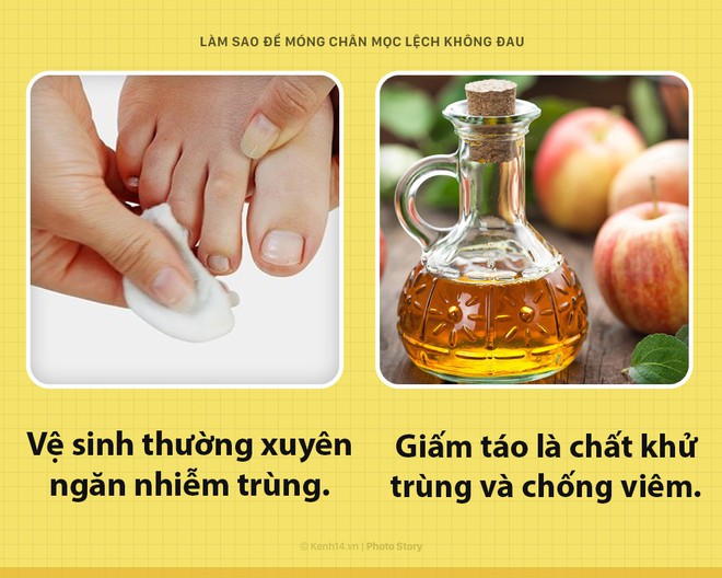 Móng chân mọc quặp đau phát khóc, mẹo nhỏ này sẽ giúp bạn thoát khỏi cơn đau - Ảnh 5.