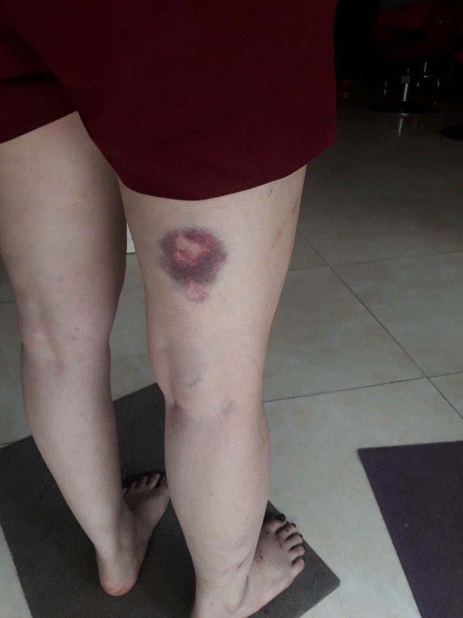Hà Nội: Chủ tiệm tóc kể lại khoảnh khắc nghẹt thở khi cùng nhân viên và nữ chủ xe SH giằng co với tên cướp có dao - Ảnh 4.