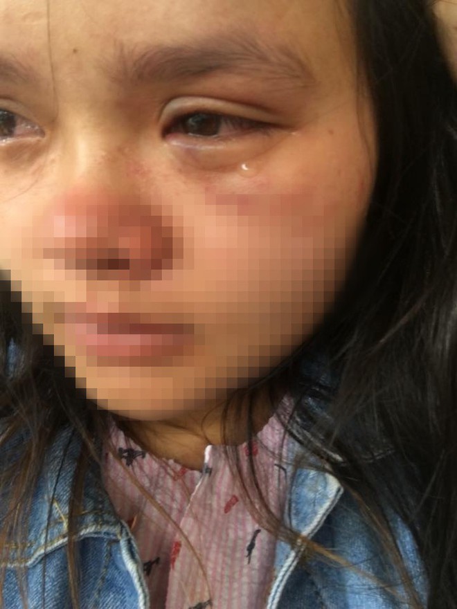 Bầu vượt mặt 9 tháng, người vợ trẻ phải livestream vì bị chồng đánh tới tấp, bầm tím mắt do nằm nghỉ không trông con - Ảnh 3.