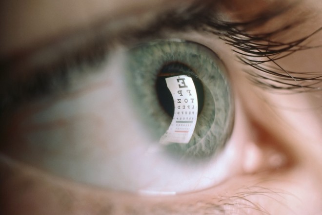 Nhận biết các bệnh dễ mắc qua những triệu chứng bất thường ở đôi mắt - Ảnh 5.
