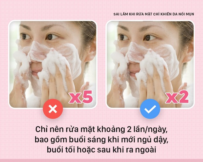 Nếu bạn cứ giữ những thói quen này khi rửa mặt thì chỉ khiến da nổi mụn nhiều hơn - Ảnh 3.