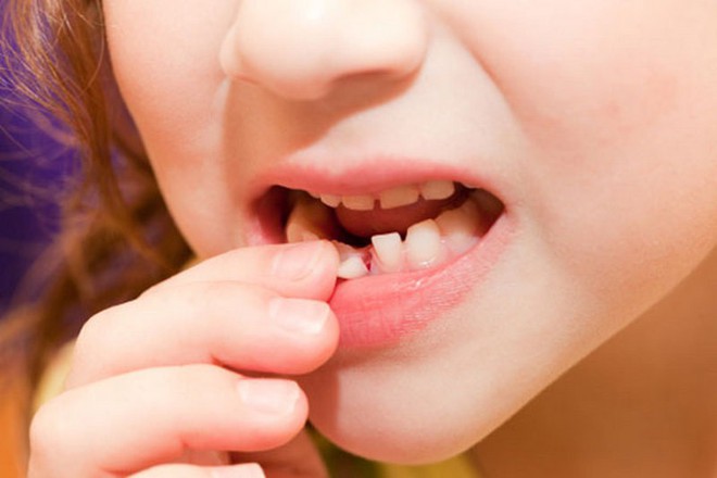 6 dấu hiệu nhận biết bệnh ung thư mũi xoang mà bạn không nên xem thường - Ảnh 5.