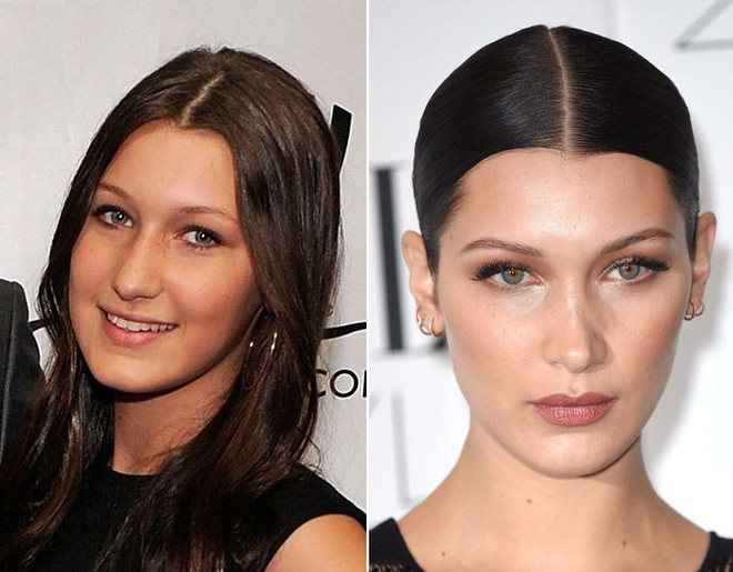 Nhan sắc thay đổi rõ rệt, Bella Hadid gây tranh cãi vì vẫn chối không đập mặt xây lại - Ảnh 1.