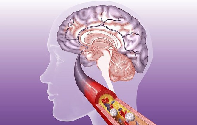 Đã tìm ra thủ phạm khiến bàn tay, ngón tay thường xuyên bị tê - Ảnh 7.