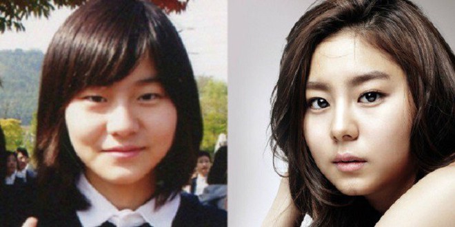 Những mỹ nh&acirc;n thừa nhận dao k&eacute;o hiếm c&oacute;: Kh&ocirc;ng những kh&ocirc;ng bị n&eacute;m đ&aacute; m&agrave; c&ograve;n được t&ocirc;n vinh v&igrave; qu&aacute; đẹp - Ảnh 18.