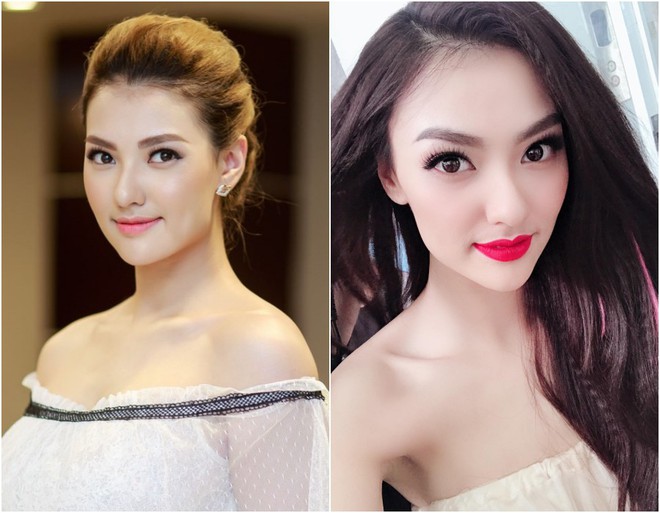 Hồng Quế n&oacute;i g&igrave; trước nghi vấn gương mặt nhọn bất thường v&igrave; dao k&eacute;o? - Ảnh 1.