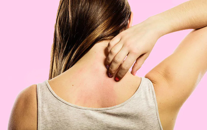 Thường xuy&ecirc;n ngứa da c&oacute; thể l&agrave; do bạn đ&atilde; mắc phải một trong 5 vấn đề sức khỏe sau - Ảnh 2.