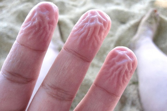 Gặp những hiện tượng n&agrave;y nhiều như cơm bữa nhưng nguy&ecirc;n nh&acirc;n v&igrave; sao ch&uacute;ng lại xảy ra th&igrave; kh&ocirc;ng phải ai cũng biết - Ảnh 6.