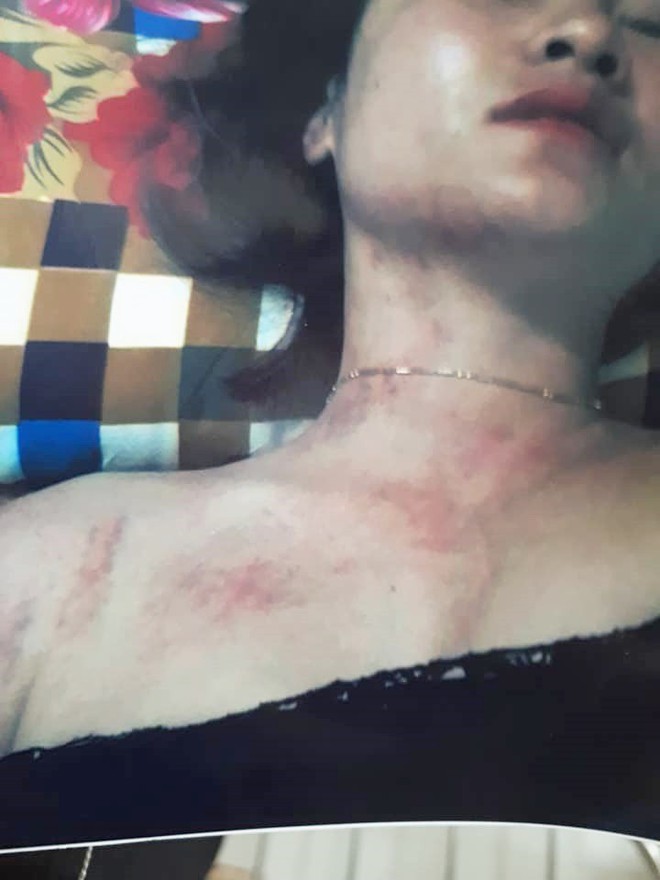 Tình tiết bất ngờ vụ vợ lên FB tố bị bạo hành: Người chồng khẳng định tất cả chỉ là chiêu trò của vợ - Ảnh 4.