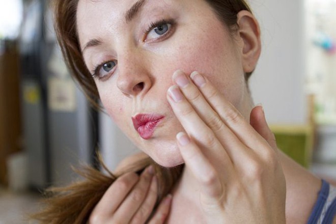 6 lời khuy&ecirc;n cực hữu &iacute;ch gi&uacute;p bạn loại bỏ những nốt mụn trứng c&aacute; đ&aacute;ng gh&eacute;t - Ảnh 4.