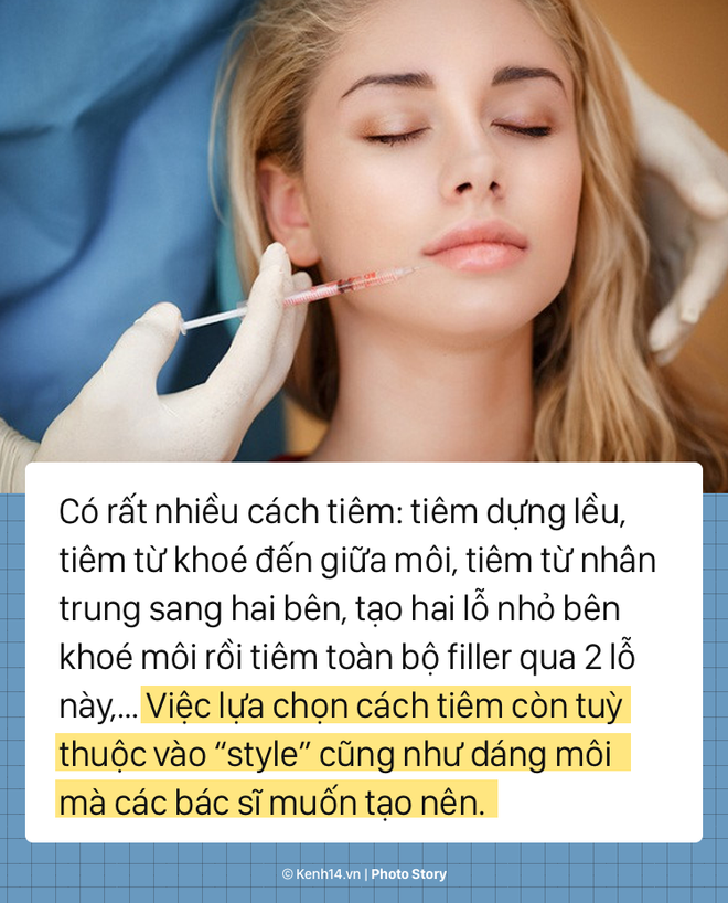 Quy trình tiêm filler để có một đôi môi tều chuẩn sexy - Ảnh 5.