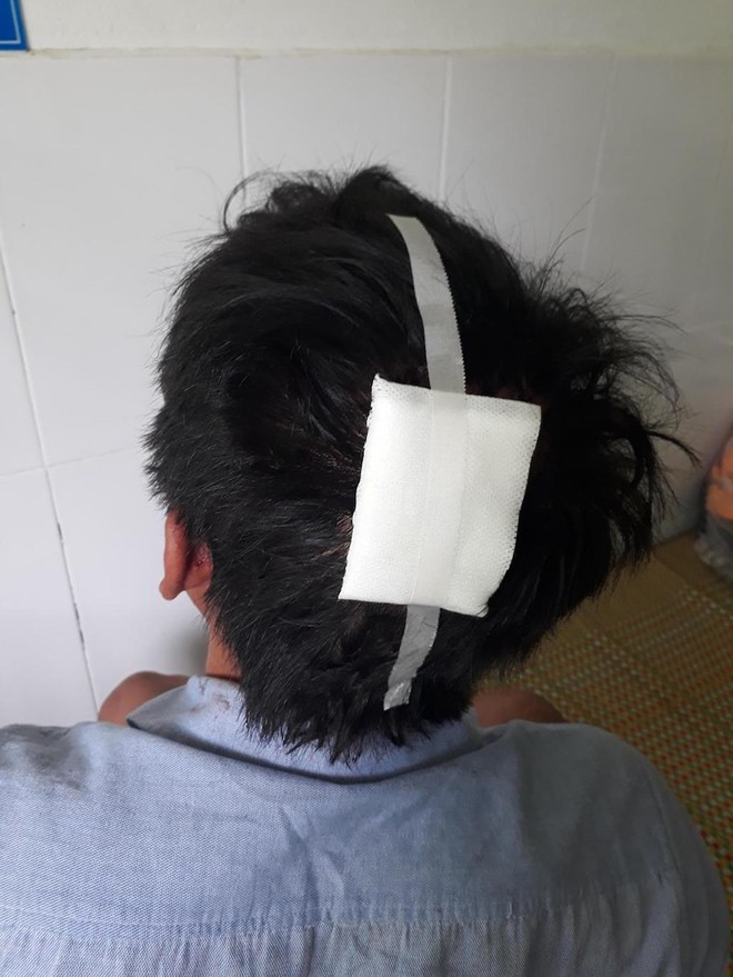 Bị hàng xóm chém vì hỏi kèo World Cup - Ảnh 1.