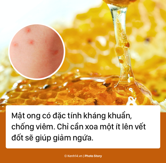 Giải quyết ngay vết muỗi đốt với các sản phẩm tự nhiên này - Ảnh 5.