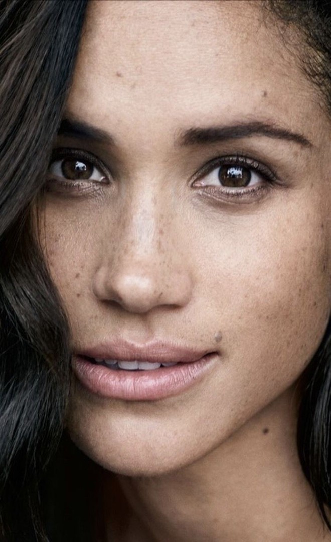 Nhờ Meghan Markle, t&agrave;n nhang lại th&agrave;nh hot trend: người vẽ t&agrave;n nhang l&ecirc;n mặt, người m&aacute;u đến mức đi xăm - Ảnh 1.