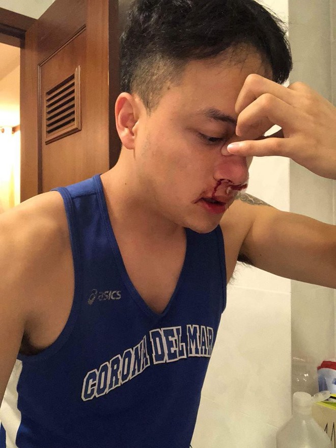 Fan lo lắng khi Cao Thái Sơn bị chảy máu mũi đến mức phải nhập viện - Ảnh 1.