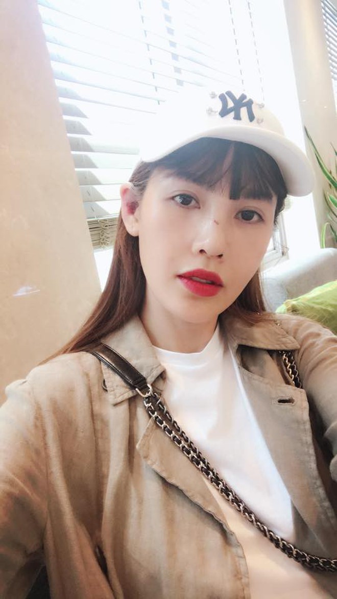 Cận cảnh gương mặt của Quế Vân sau cuộc phẫu thuật mũi lần thứ 6 - Ảnh 1.