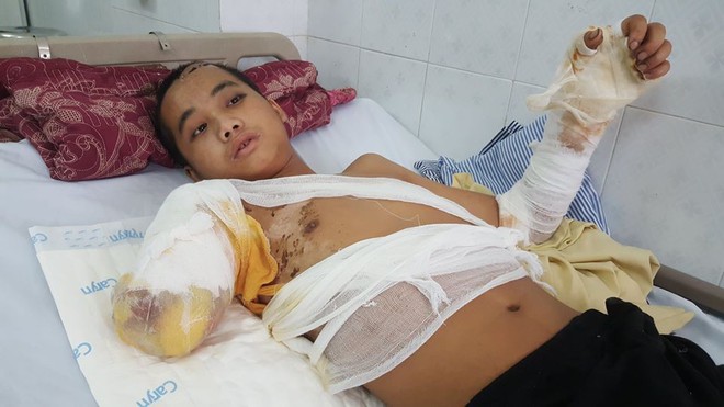 Bố chết mẹ bỏ đi biền biệt, ch&agrave;ng trai đang một m&igrave;nh nu&ocirc;i 5 em nhỏ bỗng bị điện giật cụt tay, sống lay lắt - Ảnh 4.