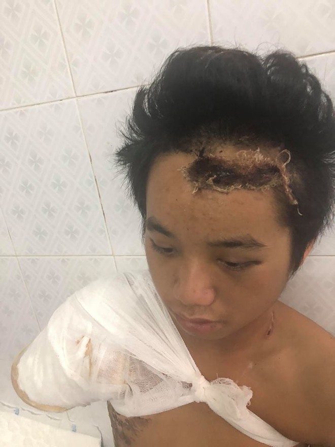 Bố chết mẹ bỏ đi biền biệt, ch&agrave;ng trai đang một m&igrave;nh nu&ocirc;i 5 em nhỏ bỗng bị điện giật cụt tay, sống lay lắt - Ảnh 5.