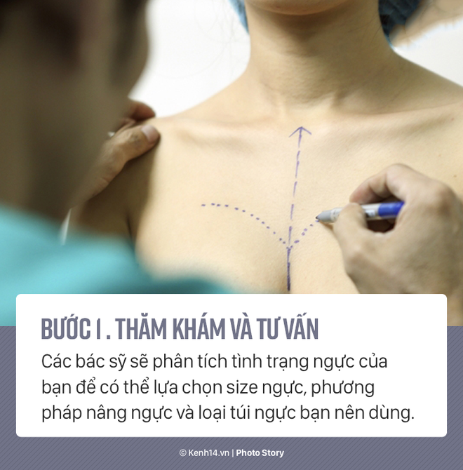 Quy trình phẫu thuật thẩm mỹ hô biến vòng 1 đồng bằng trở nên hấp dẫn - Ảnh 3.