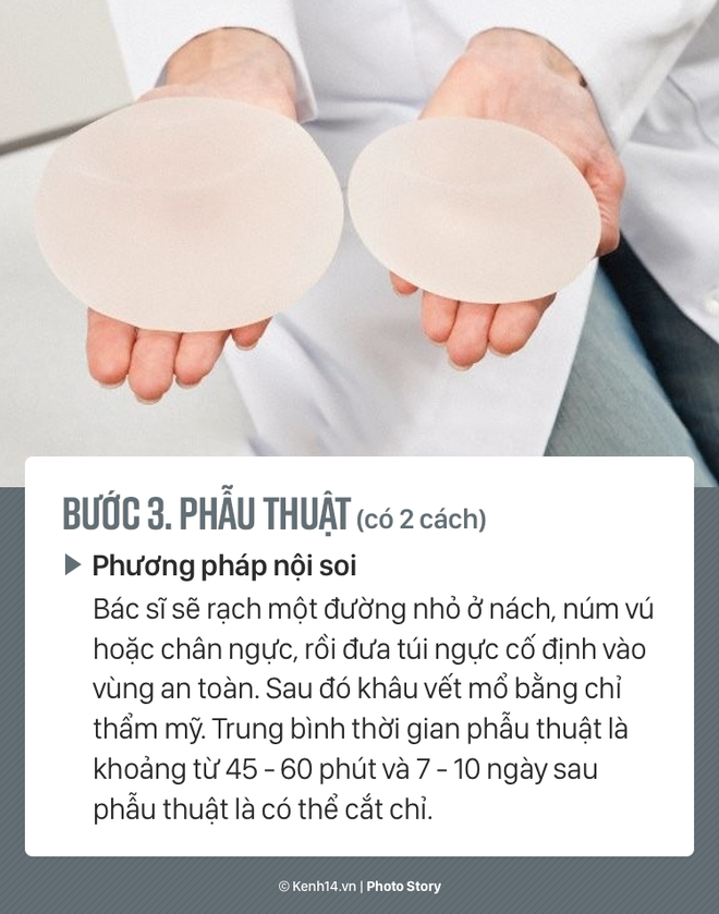 Quy trình phẫu thuật thẩm mỹ hô biến vòng 1 đồng bằng trở nên hấp dẫn - Ảnh 7.