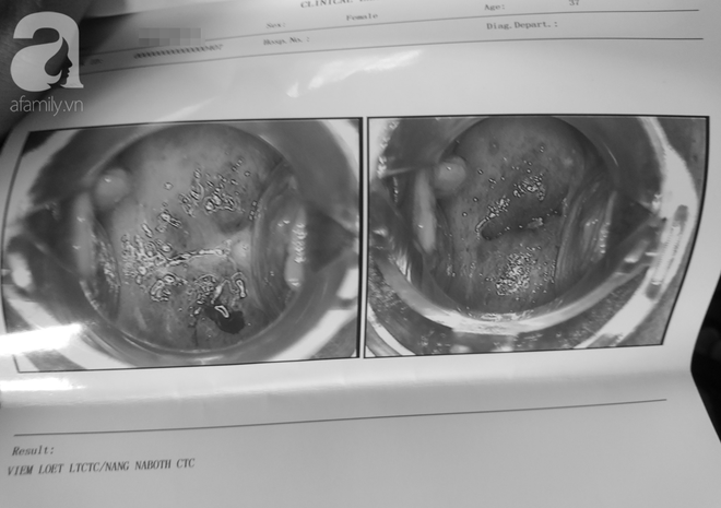 TP.HCM: Đi tháo vòng tránh thai, nữ bệnh nhân tố phòng khám đa khoa vẽ bệnh, dọa ung thư để lấy thêm tiền - Ảnh 3.