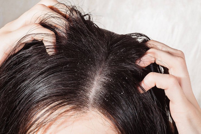 Để tóc ướt đi ngủ, bạn có thể gặp phải vô số tác hại ảnh hưởng nghiêm trọng tới sức khỏe - Ảnh 6.