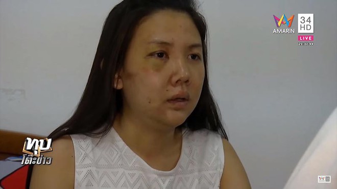 C&ocirc; g&aacute;i bị người y&ecirc;u đồng t&iacute;nh 7 năm đ&aacute;nh đập d&atilde; man l&ecirc;n tiếng: &ldquo;Vết kh&acirc;u vẫn c&ograve;n đau, cơ thể đau, l&ograve;ng cũng đau&rdquo; - Ảnh 1.