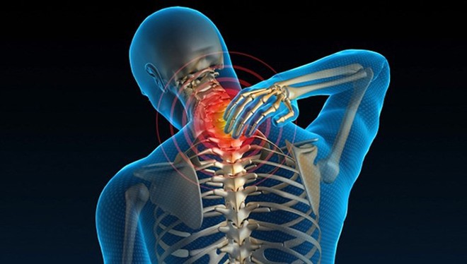 Nguyên nhân thường gặp của đau cổ - Ảnh 7.