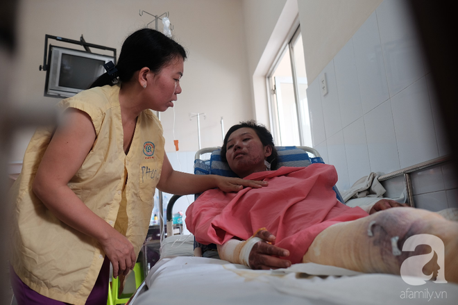 Lên Sài Gòn làm việc phụ mẹ nuôi em, thiếu nữ 18 tuổi bị bình gas mini làm bỏng nặng - Ảnh 8.
