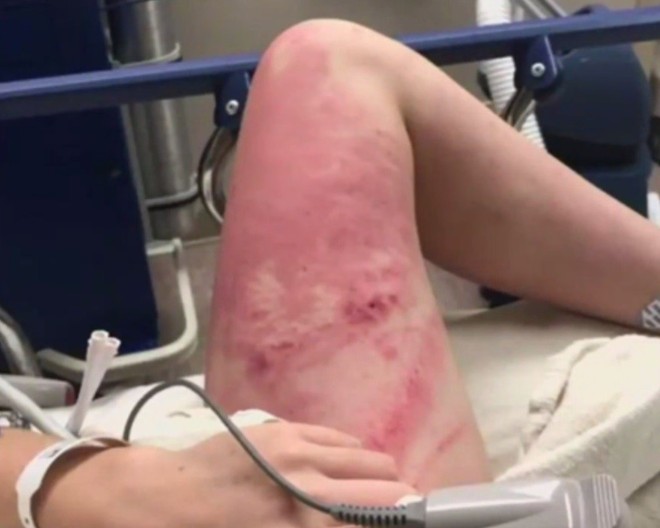 Mỹ: Cô gái 16 tuổi chấn thương nặng sau khi bị bạn đẩy từ cầu cao hơn 10m - Ảnh 3.