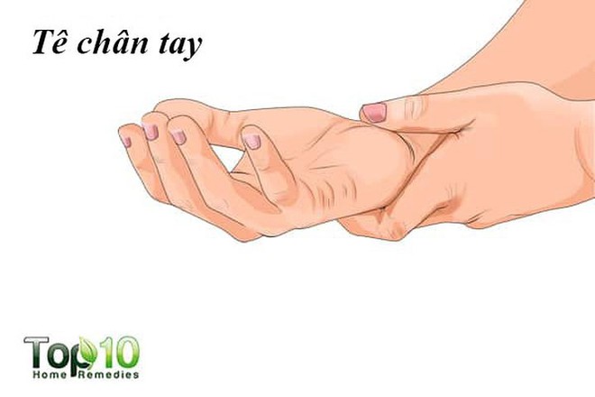 Dấu hiệu cho biết bạn c&oacute; thể bị tổn thương thần kinh - Ảnh 1.