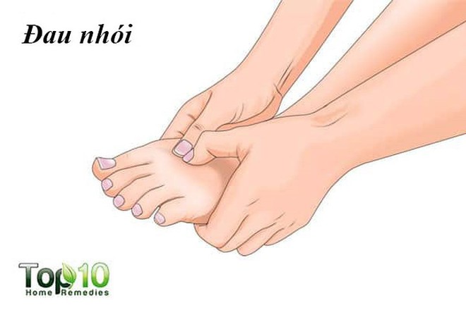 Dấu hiệu cho biết bạn c&oacute; thể bị tổn thương thần kinh - Ảnh 2.