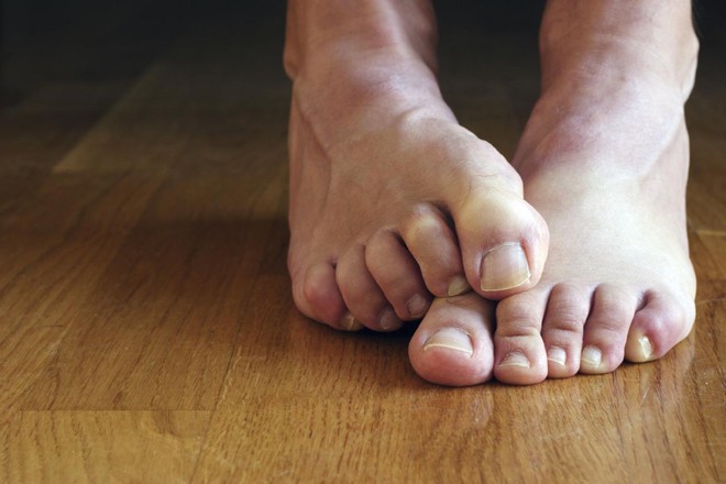 Hôi chân thường xuất hiện trong tiết trời nồm ẩm, làm thế nào để xử lý triệt để? - Ảnh 3.