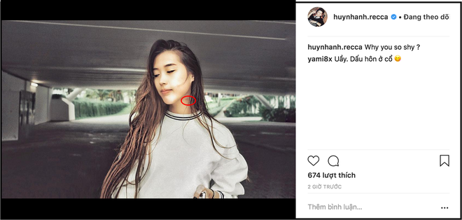 T&igrave;nh mới Huỳnh Anh li&ecirc;n tục bị soi vết bầm kh&oacute; hiểu tr&ecirc;n cổ trong loạt ảnh mới do bạn trai tự tay chụp - Ảnh 2.