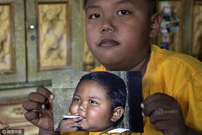 Indonesia: Cậu bé 2 tuổi hút 40 điếu thuốc lá/ngày, thậm chí trở nên hung dữ mất kiểm soát nếu thiếu nicotine - Ảnh 5.