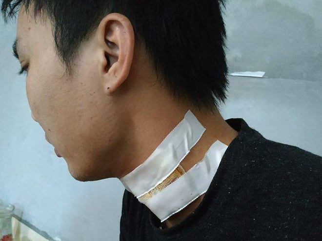 Lời khai sốc của hai hung thủ cứa cổ t&agrave;i xế taxi trong đ&ecirc;m - Ảnh 2.