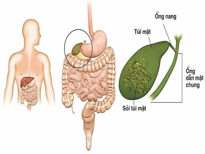 Hậu quả khôn lường khi nhịn ăn để giảm cân - Ảnh 4.