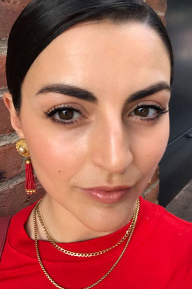 Thử d&ugrave;ng miếng d&aacute;n x&oacute;a nếp nhăn thay v&igrave; ti&ecirc;m botox, c&ocirc; n&agrave;ng n&agrave;y nhận được kết quả mỹ m&atilde;n - Ảnh 5.