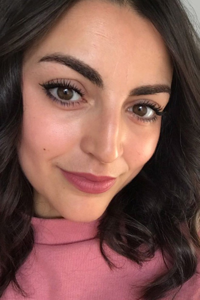 Thử d&ugrave;ng miếng d&aacute;n x&oacute;a nếp nhăn thay v&igrave; ti&ecirc;m botox, c&ocirc; n&agrave;ng n&agrave;y nhận được kết quả mỹ m&atilde;n - Ảnh 1.