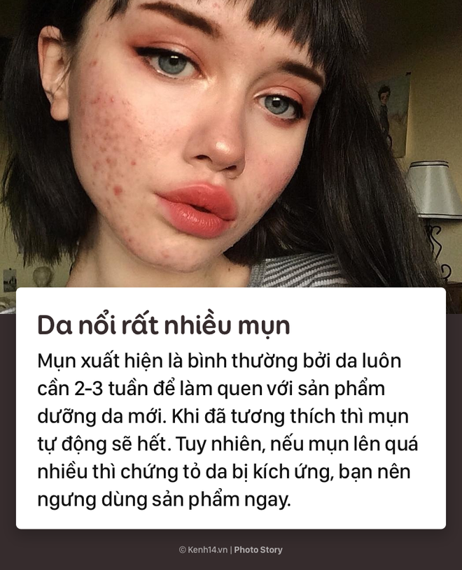 Dừng ngay sản phẩm dưỡng da đang d&ugrave;ng nếu l&agrave;n da của bạn xuất hiện những triệu chứng sau - Ảnh 5.