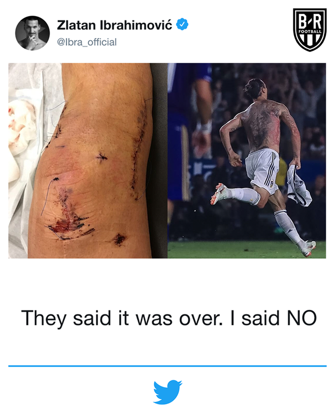 Ibrahimovic lần đầu tiết lộ hình ảnh chấn thương đáng sợ ở MU - Ảnh 1.