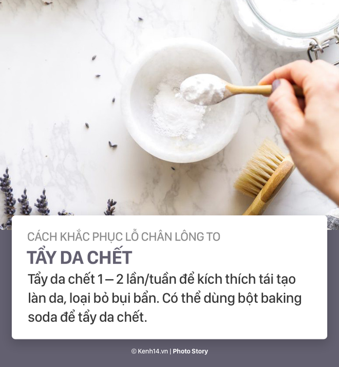 Nỗi &aacute;m ảnh lỗ ch&acirc;n l&ocirc;ng to v&agrave; c&aacute;ch l&agrave;m bay biến ch&uacute;ng - Ảnh 11.