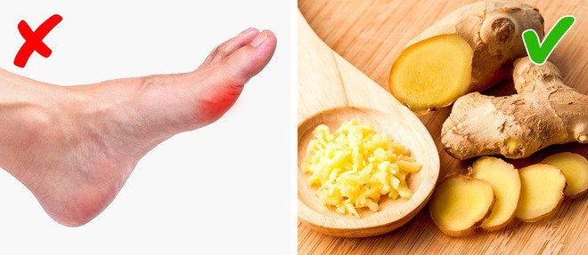 Sự thật: ngày càng nhiều người bị gout và đây là cách để hạn chế những cơn đau kinh khủng ấy - Ảnh 5.