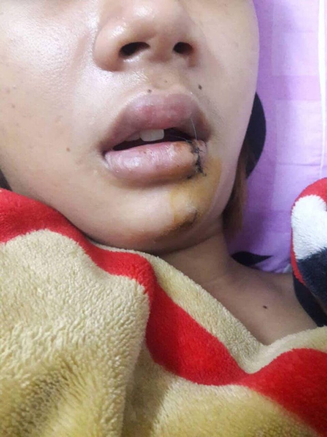 Thiếu nữ 14 tuổi kể lại thời khắc kinh ho&agrave;ng khi bị nh&oacute;m thanh ni&ecirc;n chặn đường truy s&aacute;t giữa đ&ecirc;m ở S&agrave;i G&ograve;n - Ảnh 2.