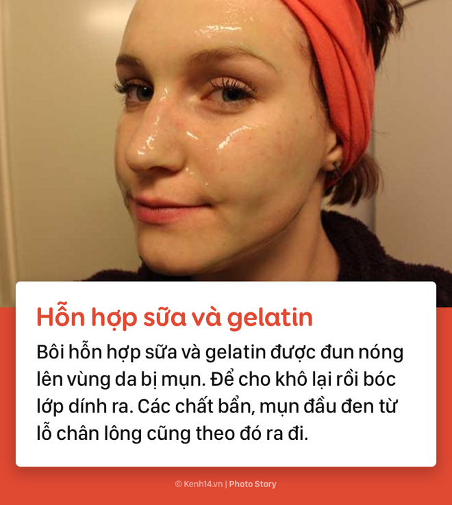 Học ngay những c&aacute;ch sau để xo&aacute; đi mụn đầu đen xấu x&iacute; lấm tấm tr&ecirc;n gương mặt - Ảnh 13.